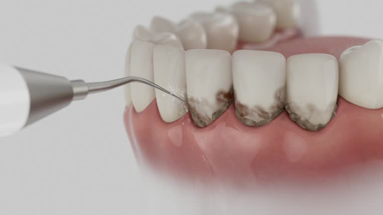 Reliable Dental contractor in Wooster, AR by Smile Center Dentistry